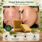 Bıttım & Biberiye Sabunu | Saç ve Cilt Canlandırıcı & Dökülme Karşıtı